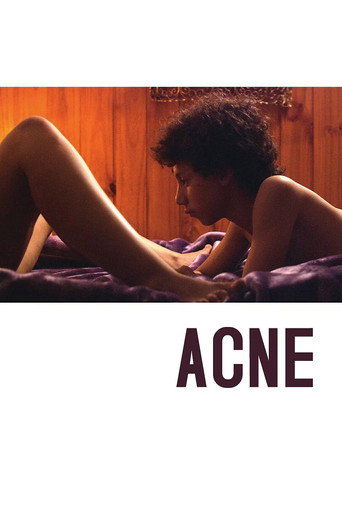 Постер фильма «Acné»