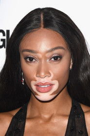 Фото: Winnie Harlow